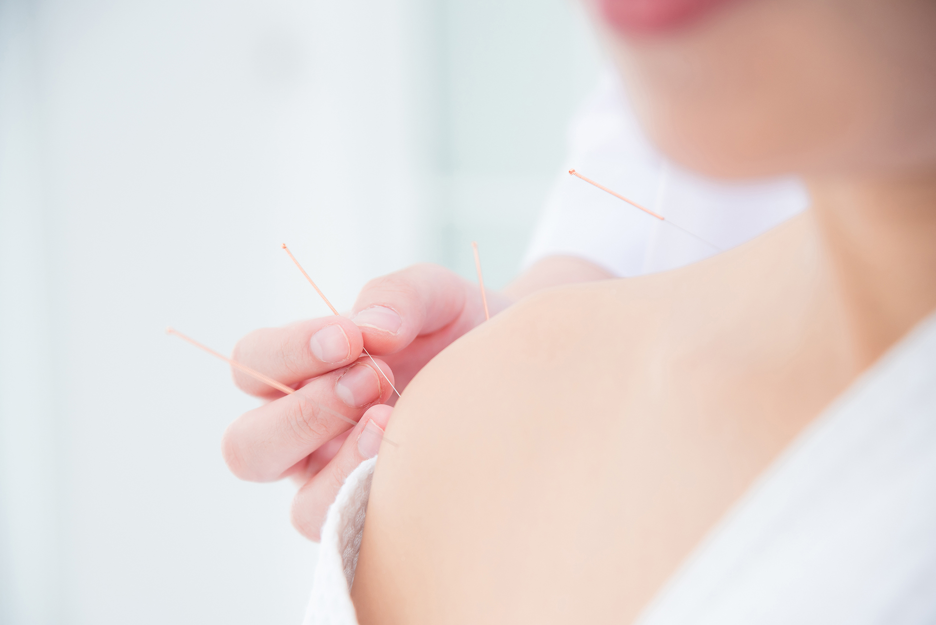 Close up of hands doing acupuncture with at patient shoulder ,Al